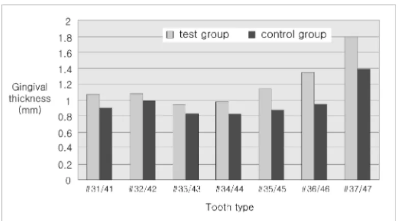 Figure  3.  Gingival  thickness  of  the  mandibular  teeth