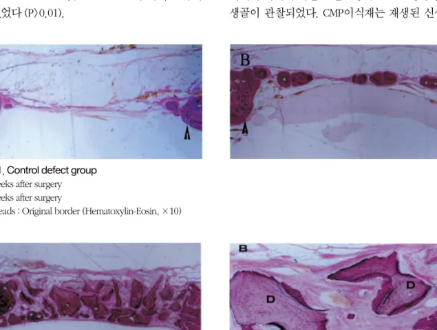 Figure 1. Control defect group A. 12 weeks after surgery B. 24 weeks after surgery