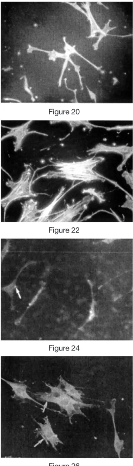 Figure 19 Figure 20