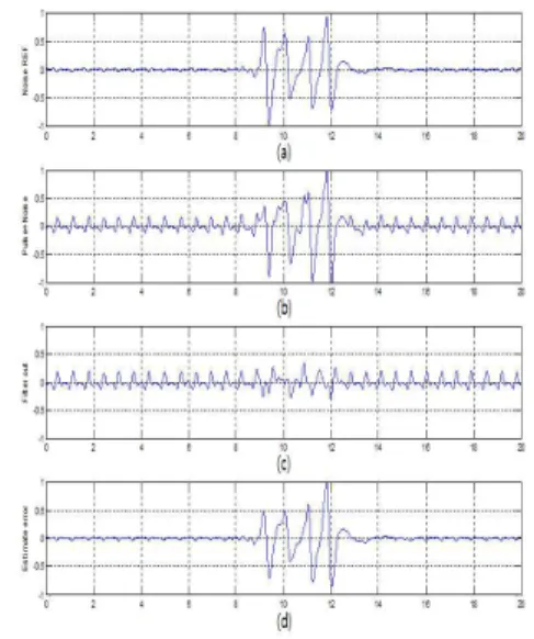 Figure  6.  Result  of  the  proposed  method(finger  movement)  (a)  Noise  reference  signal  with  motion  artifacts  (b)  input  signal(Pulse  with  motion  artifacts)  (c)  Output  of  adaptive  (d)  Estimate  signal