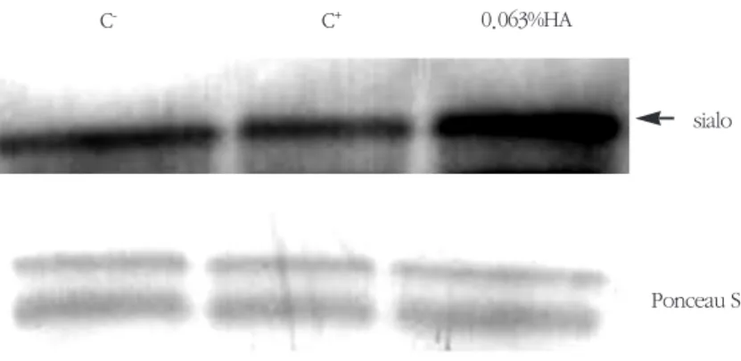Figure 6. Western blot analysis for intracellular levels of BSP in hFOB1. First lane is negative control group and the second is dexamethasone group, and the last one is the experimental group supplemented with 0.063%  HA