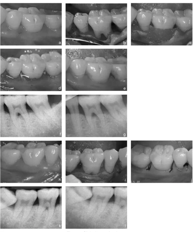 Figure 1. Clinical case of patient 2