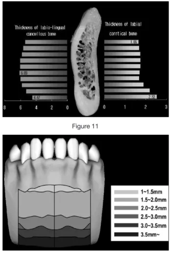 Figure 12Figure 11