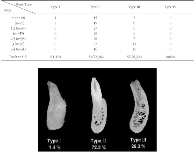Fig 3. The distribution of Bone quality