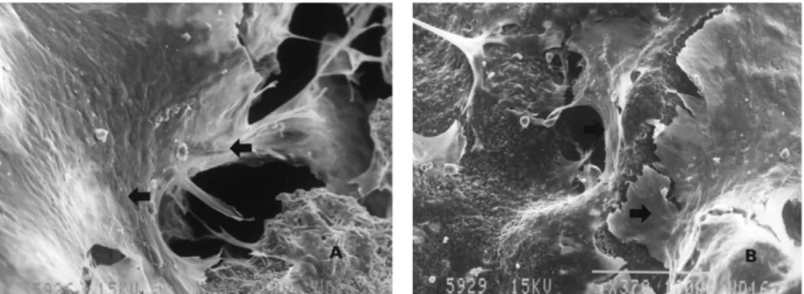 Figure 6. SEM view of after 14 days of seeding(×400). a) CPP-45ppi, b) CPP-60ppi. Arrow marks indicate the proliferated cells on the CPP surface.