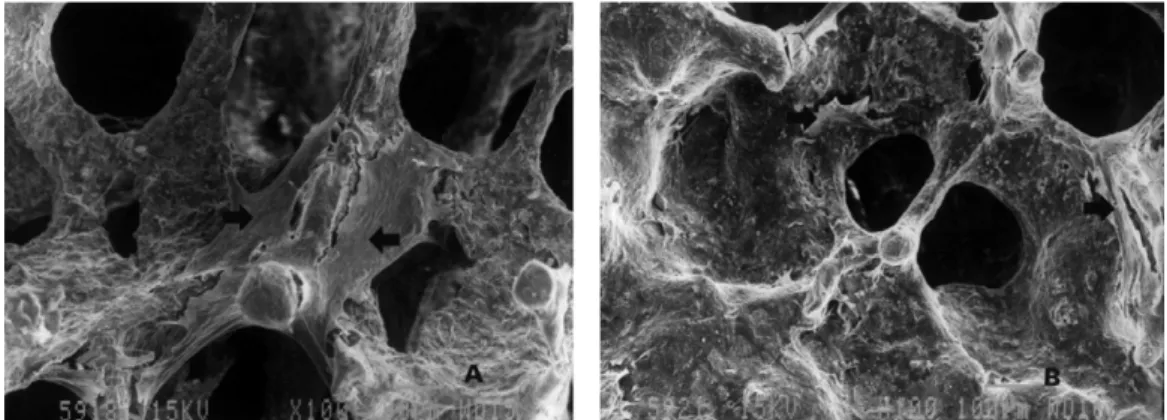 Figure 8. High  magnification  of  Fig.  7(×400).  a)  CPP-45ppi,  b)  CPP-60ppi.  Arrow  marks  indicate theattached cells on the CPP surface.