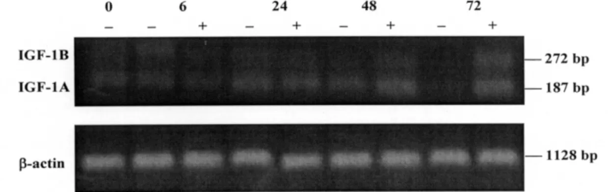 Figure 1. Effect of 17β-estradiol on expression of IGF-I mRNA in MC3T3-E1 cells. Cells were seeded 5×10 5 cells at 100mm culture plate in alpha-modified Eaglemedium containing 10% fetal bovine serum