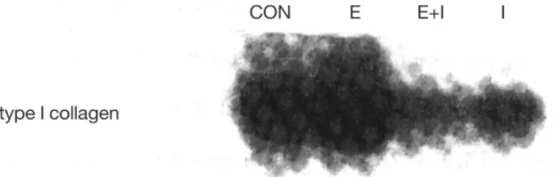 Figure 3. Effect of 17 β -estradiol and IGF-I on expression of type I collagen mRNA in MC3T3-E1 cells