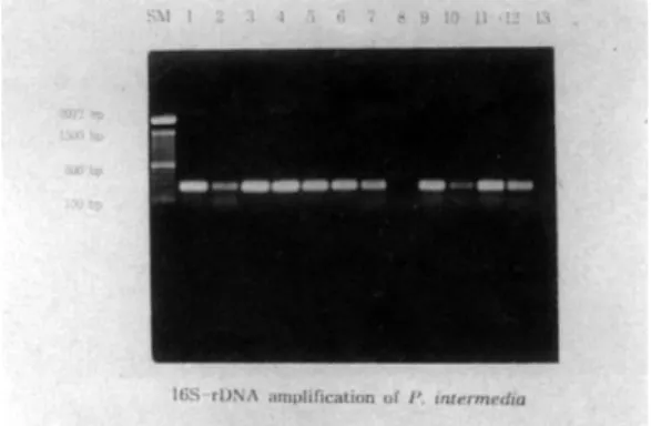 Figure 3. 16S-rDNA  amplification  of Prevotella nigrescens