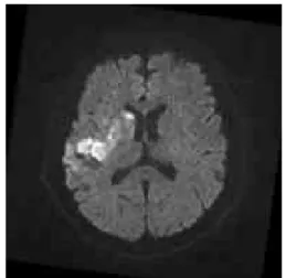 그림 2. 보정된 MRI 뇌영상 Fig 2. Corrected MRI Brain image