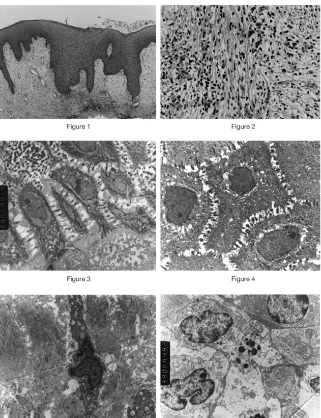 Figure 1 Figure 2