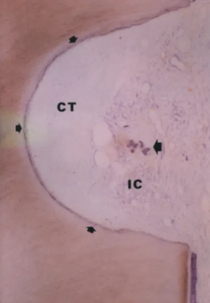 Figure  4.  PDGF-BB  loaded  membrane  specimen  at  3 weeks. 
