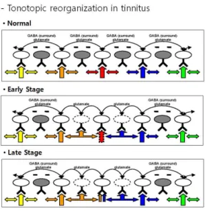 Fig.  2.  EEG  related  tinnitus  to  compensate  the  gap,  A  :  Original, 