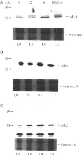 Figure  3.  Western  blot  analysis  for  the  intracellular  p53 and p21WAF1/CIP1 levels in human PDL cells exposed to mechanical stress for 0, 2, 6, or 10 days