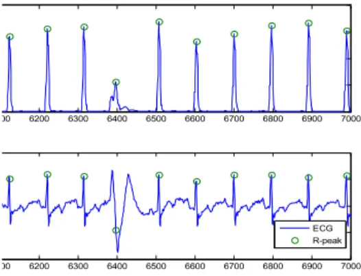 Fig 4. Extraction of R-peak by Moving Average Filter with a size=0.04sec