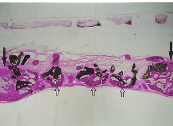 Figure 6. CMP group after 6 weeks of healing in rabbit cal- cal-varial defect. Figure illustrates CMP(C) matrix in the defect