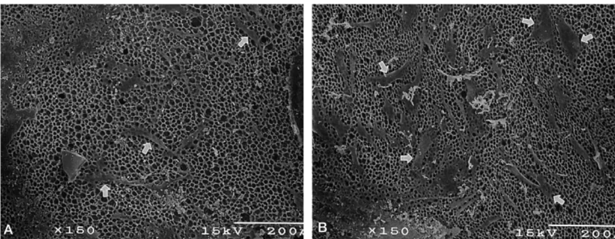 Figure 2. Scannining electron micrograph of osteoblasts attached on the PLLA membrane