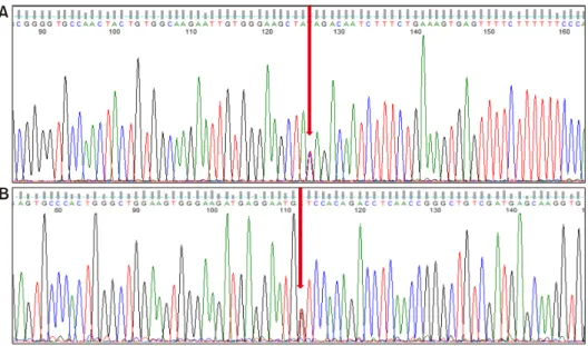 Figure 4. Sanger sequencing of  the mutations in allele c.2548 C＞T (p.Gln850*) (nonsense  mutation) (A) and c.3051G＞T  (p.Trp1017Cys) (missense  mu-tation) (B) (arrows).