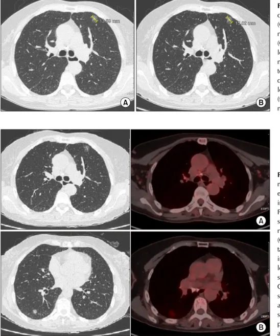 Figure 2.  Chest computed to- to-mography (CT) and positron  emission tomography (PET)-CT  images