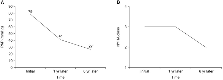 Figure 1. Chest computed tomography. Interstitial pneumo- pneumo-nitis and bilateral pleural effusion