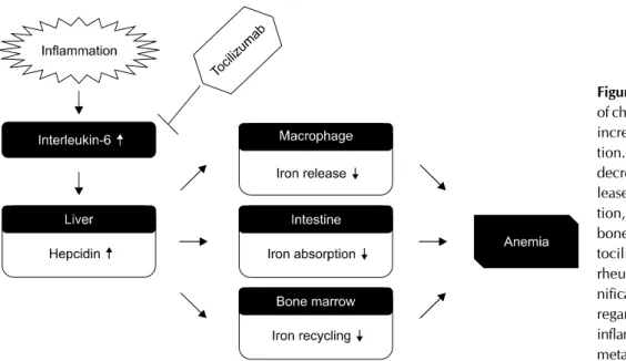 Figure 1. Hepcidin and anemia of chronic disease. Inflammation  increases interleukin-6  produc-tion