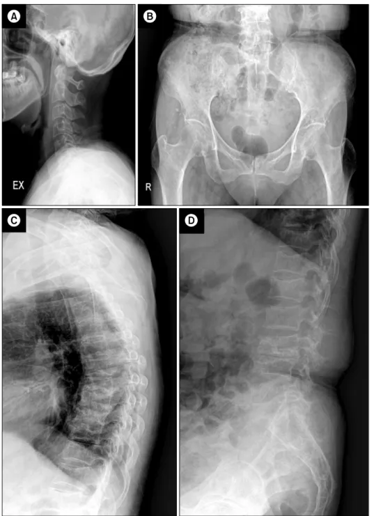 Figure 1.  Plain radiography. 