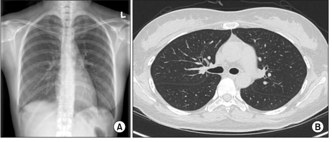 Figure 2. 6  weeks  after  treatment. 