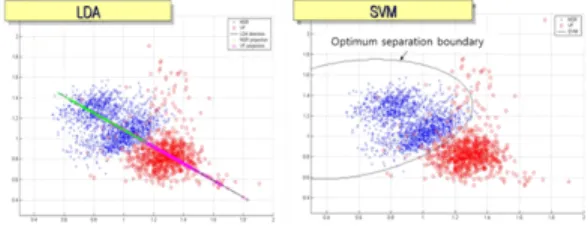 그림 5. LDA, SVM을 이용한 부정맥 검출 알고리즘 Fig. 5. Arrhythmia Detection Algorithmusing LDA and SVM