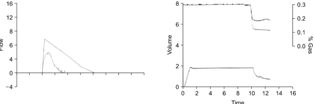 Fig. 1. Pulmonary  function  test  showed  restrictive  pattern  and  reduced  diffusion  capacity  (forced  vital  capacity  [FVC],  46%:  forced  expiratory  volume  in  1  sec  [FEV1],  53%:  CO  diffusing  capacity  [DLCO],  44%).