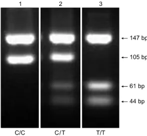 Fig. 1. Representative  agarose  gel  electrophoresis  illust- illust-rating  polymerase  chain  reaction-restriction   frag-ment  length  polymorphism  (PCR-RFLP)  products  for  the  Eta-1/osteopontin  gene  polymorphism