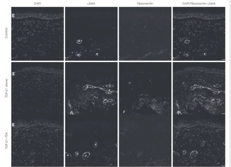 Fig. 4. Immunofluorescent staining of α-SMA and fibronectin expression were captured and visualized by confocal z-stack laser  scanning microscopy (original magnification, ×200; scale bar=20 μm)