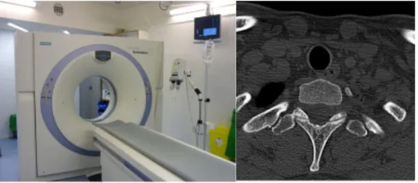 그림 1. CT 스캐너 장치와 단층 촬영 영상 Fig. 1. CT Scanner and Computed Tomography imagewhich makes simulation possible with the manufactured information, the paper attempts to providea more effective way to approach academic studies or giving appropriate diagnoses in t