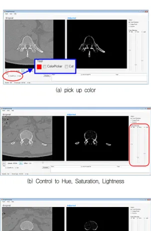 Fig. 9. The process of extracting point clouds for the lumbar spine