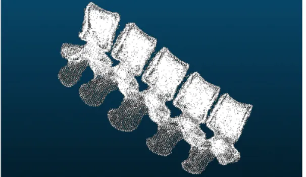 그림 11. 제2 요추만 분할하여 3D로 표현한 화면 Fig. 11. Point clouds 3D view of Lumbar 2