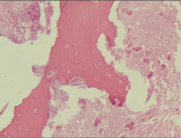 Fig. 7. Many  plasma  cells,  neutrophils  and  capillaries  in granulation tissue are seen.(H&amp;E staining, original  magnifi-cation ×200).