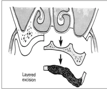 Fig. 9. Postoperative Water’s view.