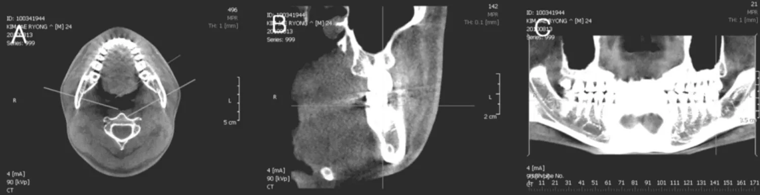 Fig. 2. Measuring  points  and  measurements  in  the  cross sectional images.