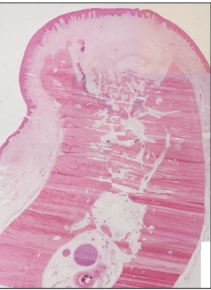 Fig. 6. Combined view of the healing of normal and infected extraction wounds.