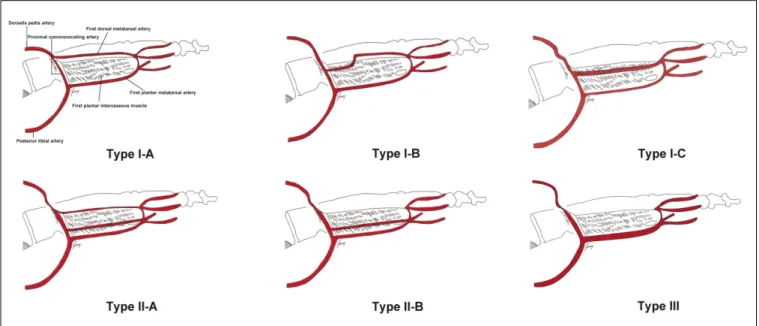 Fig. 4. Schematic drawings of various patterns of the FDMA according to the positional relationship between the FDMA and the FDIM
