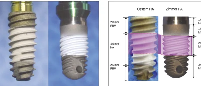 Fig. 1. TS III HA and Zimmer HA. Fig. 2. Bone-implant contact measuring area. 