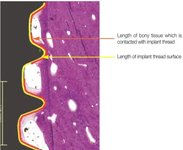 Fig. 3. Bone-implant contact measuring method.