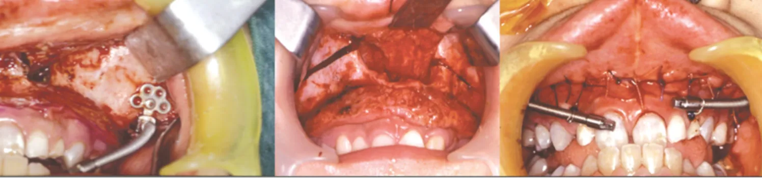 Fig. 1. Clinical photographs at surgery. 