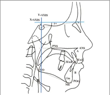 Fig. 3. Representation  of  landmarks  and  constructed  lines used  to  identify  craniofacial  and  dental  parameters  on   lat-eral  cephalometric  radiograph