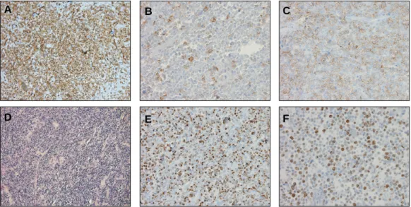 Fig. 3. The findings of immunohistochemistry and in situ hybridization. 