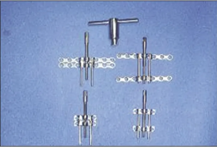 Fig. 1. Intraoral vertical alveolar distractor.