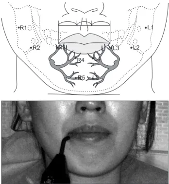 Fig. 1. Gentle-Pulse Pulp Vitality Tester D624MS (Parkell Inc.,  Edgewood, NY, USA).