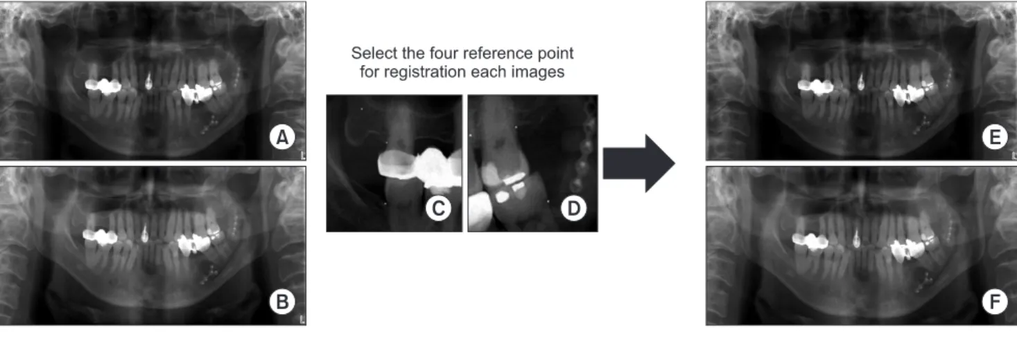 Fig. 1. Image registration processing by image subtraction tool program (Sunny, Biomedisys Co