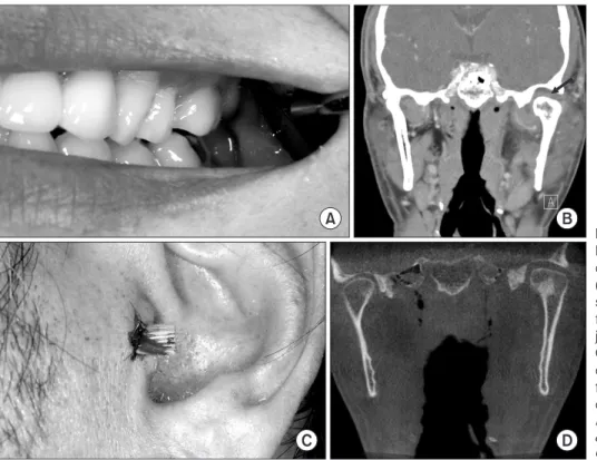Fig.  1.  A.  Clinical  findings  in  Case  1. 
