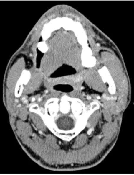 Fig. 8. Post-operative computed tomography (15-months after). 