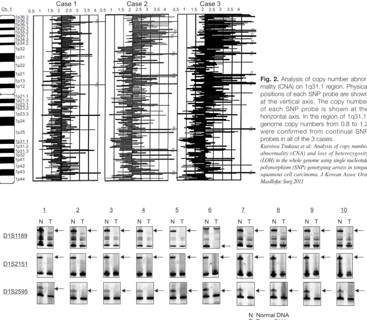 Fig. 2. Analysis of copy number abnor- abnor-mality (CNA) on 1q31.1 region. Physical  positions of each SNP probe are shown  at  the  vertical  axis